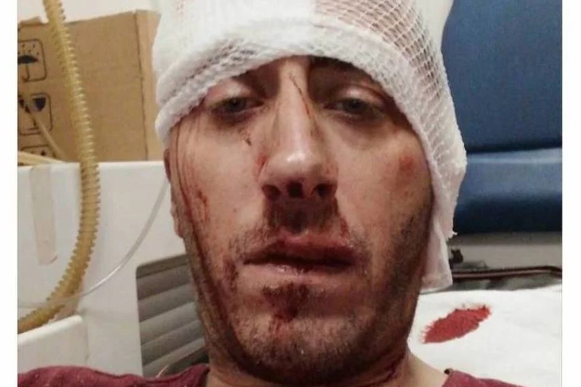 Banja Luka journalist brutally beaten