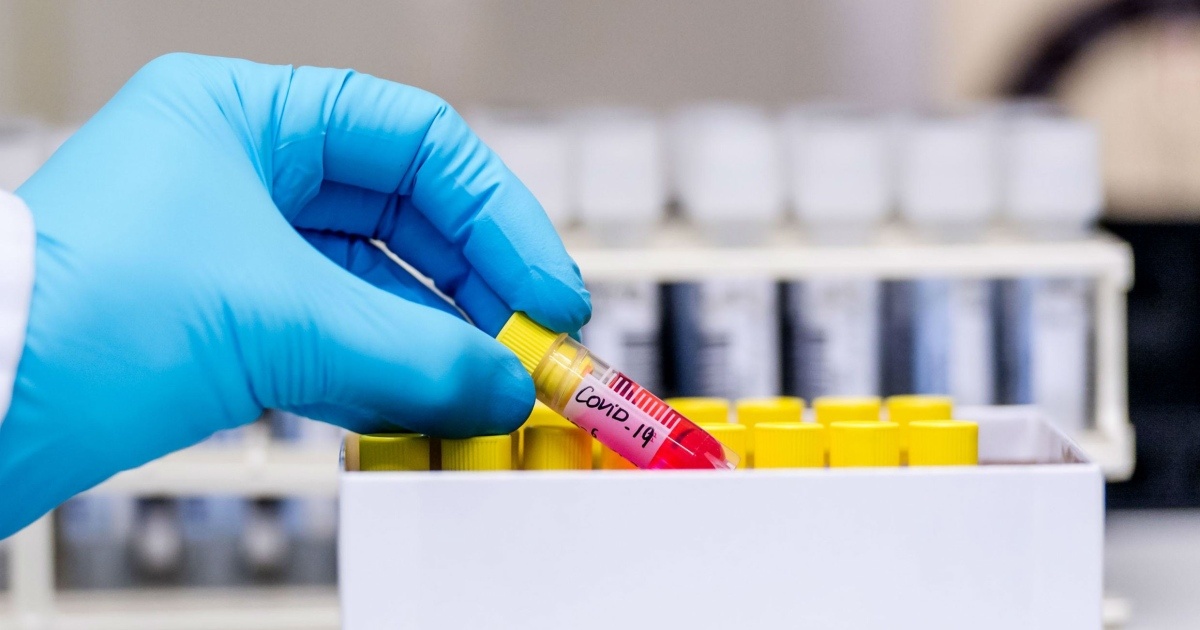 Coronavirus incidences increase, Montenegro, Kosovo remain incident-free