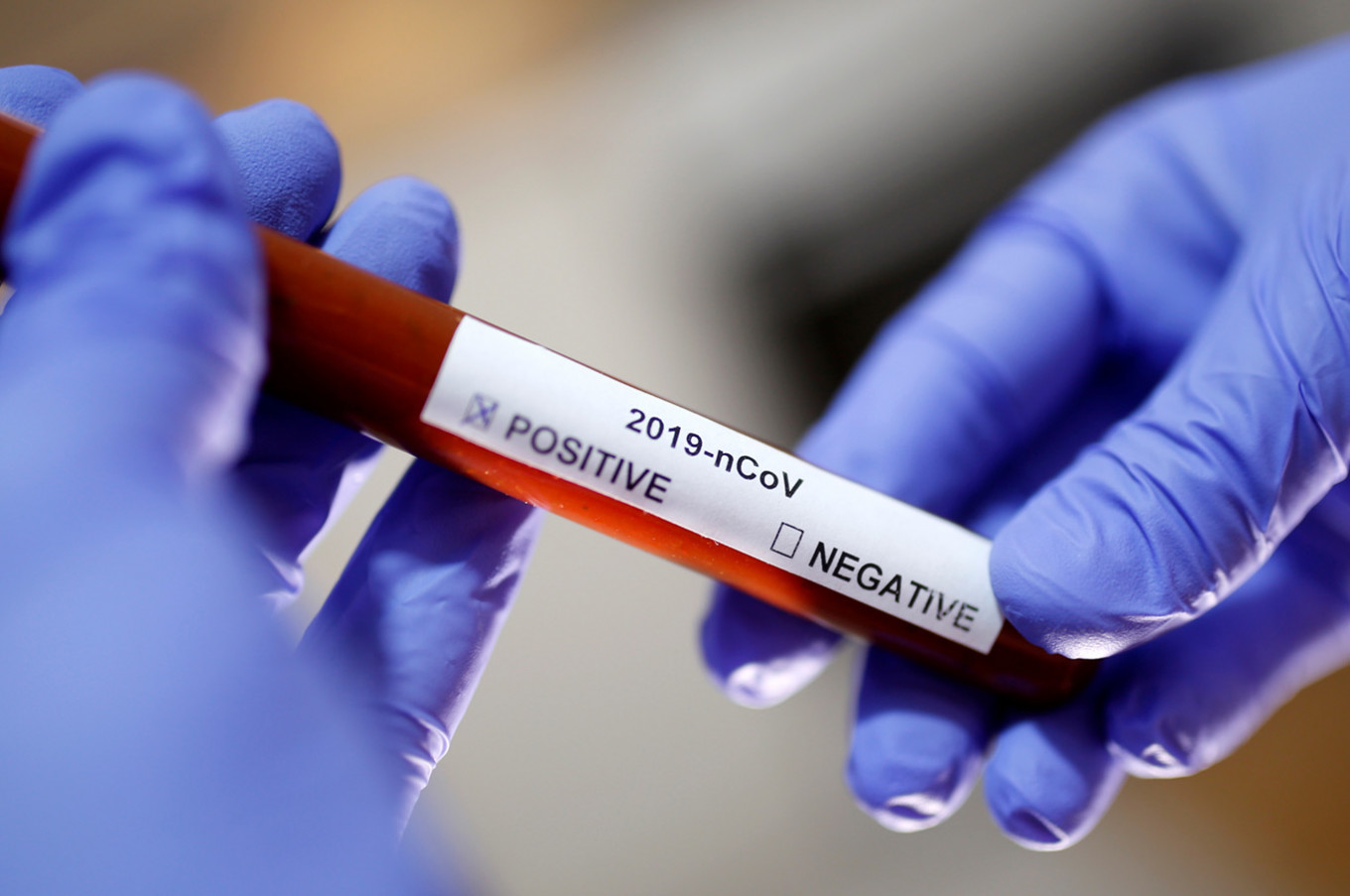 Greece: Death toll rises to 10 – 495 confirmed coronavirus outbreaks