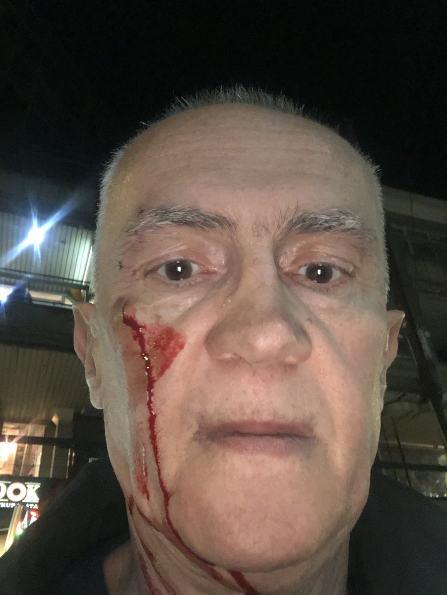 Πρώην Σέρβος αξιωματούχος για τα ανθρώπινα δικαιώματα δέχθηκε επίθεση στο Βελιγράδι